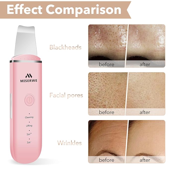 Skin Scrubber Face Skin Spatula Facial Scrubber Spatula Pore Cleaner with 4 Modes (Pink)